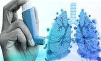 راهنمای آموزش بیمار مبتلا به آسم 1403